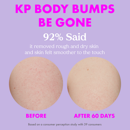 KP Body Bumps Be Gone Scrub
