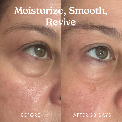Ceramide & Retinol Dual-Core Eye Balm