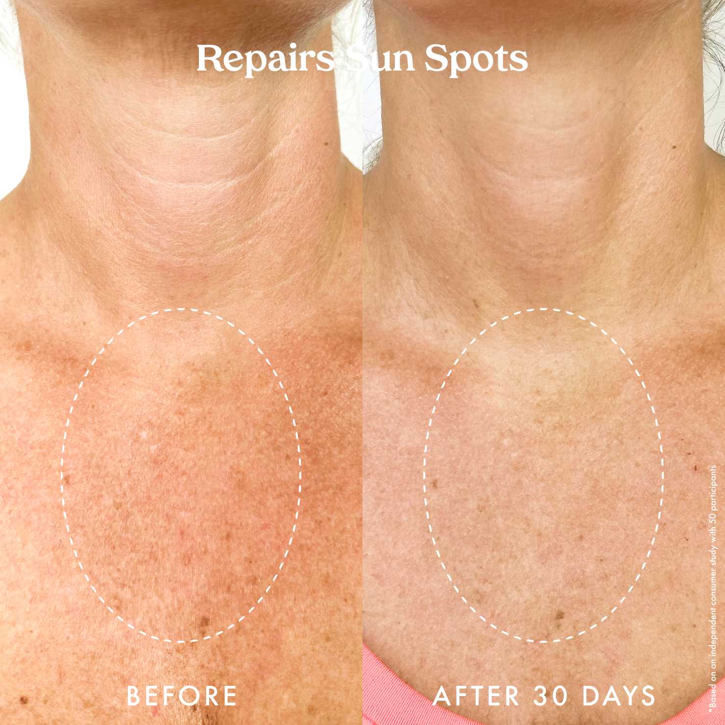 Ultra Renewal Retinol Body Cream
