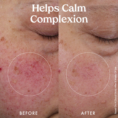 Mini Nourishing Hydro-Lipid Barrier Serum