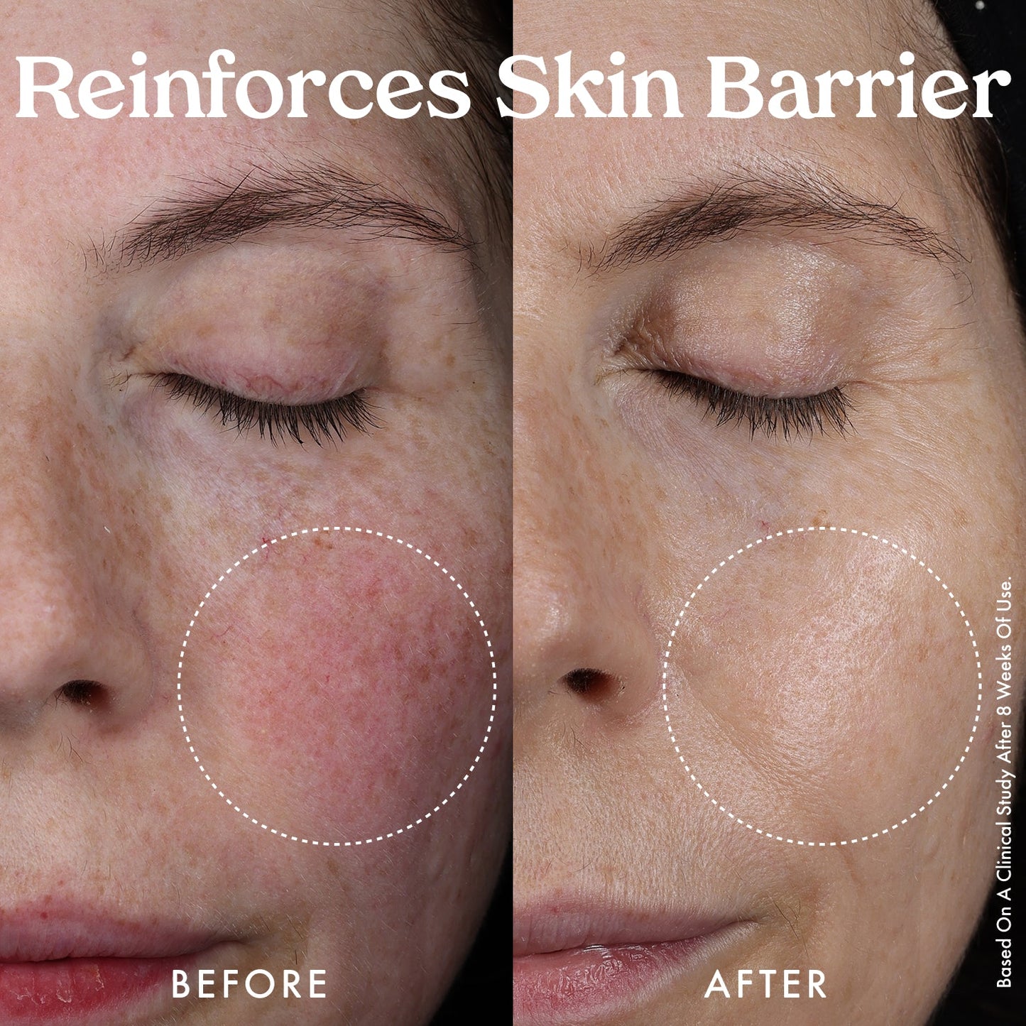 Mini Nourishing Hydro-Lipid Barrier Serum